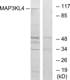 Anti-MLK4 antibody used in Western Blot (WB). GTX87671