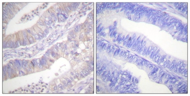 Anti-CFTR antibody used in IHC (Paraffin sections) (IHC-P). GTX87672