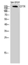 Anti-CFTR antibody used in Western Blot (WB). GTX87672