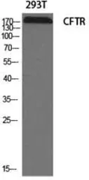 Anti-CFTR antibody used in Western Blot (WB). GTX87672
