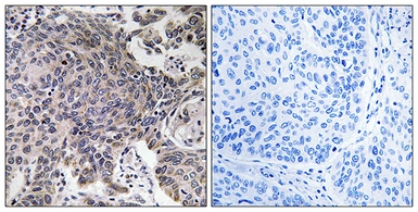 Anti-MRPL54 antibody used in IHC (Paraffin sections) (IHC-P). GTX87675