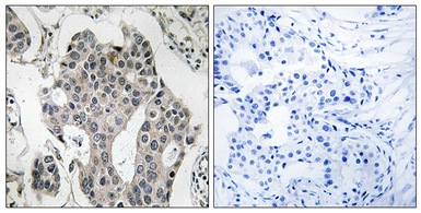 Anti-RAB3GAP2 antibody used in IHC (Paraffin sections) (IHC-P). GTX87680