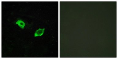 Anti-GPR158 antibody used in Immunocytochemistry/ Immunofluorescence (ICC/IF). GTX87693