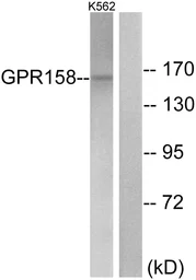 Anti-GPR158 antibody used in Western Blot (WB). GTX87693