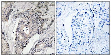 Anti-THBS4 antibody used in IHC (Paraffin sections) (IHC-P). GTX87694