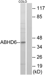 Anti-ABHD6 antibody used in Western Blot (WB). GTX87697