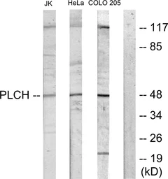 Anti-GPAT3 antibody used in Western Blot (WB). GTX87708