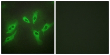 Anti-TUSC3 antibody used in Immunocytochemistry/ Immunofluorescence (ICC/IF). GTX87753