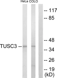 Anti-TUSC3 antibody used in Western Blot (WB). GTX87753