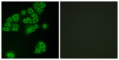 Anti-GPR180 antibody used in Immunocytochemistry/ Immunofluorescence (ICC/IF). GTX87760