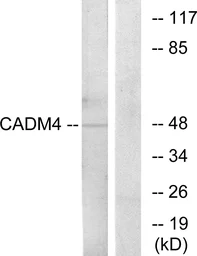 Anti-CADM4 antibody used in Western Blot (WB). GTX87808