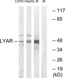Anti-LYAR antibody used in Western Blot (WB). GTX87852