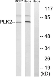 Anti-PLK2 antibody used in Western Blot (WB). GTX87865