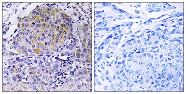 Anti-CEP78 antibody used in IHC (Paraffin sections) (IHC-P). GTX87967