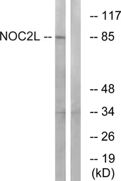 Anti-NOC2L antibody used in Western Blot (WB). GTX87980