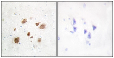 Anti-CaMKI beta antibody used in IHC (Paraffin sections) (IHC-P). GTX88001