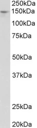 Anti-Pex1 antibody, Internal used in Western Blot (WB). GTX88030