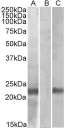 Anti-Cystatin 8 (aa 100-112) antibody, Internal used in Western Blot (WB). GTX88034