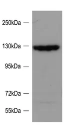 Anti-SRGAP2 antibody, Internal used in Western Blot (WB). GTX88045