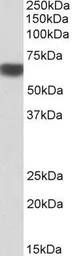 Anti-AMPK alpha 2 antibody, Internal used in Western Blot (WB). GTX88046