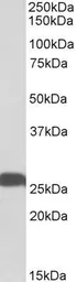 Anti-PGP9.5 antibody, Internal used in Western Blot (WB). GTX88056