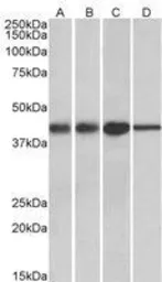 Anti-ACAT1 (aa257-269) antibody, Internal used in Western Blot (WB). GTX88076