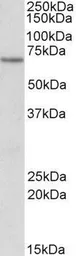 Anti-ETFDH antibody, Internal used in Western Blot (WB). GTX88086