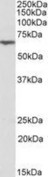 Anti-ANTXR2 antibody, Internal used in Western Blot (WB). GTX88121