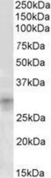 Anti-IGFBP7 antibody, Internal used in Western Blot (WB). GTX88132
