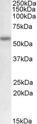 Anti-MMP12 antibody, Internal used in Western Blot (WB). GTX88142