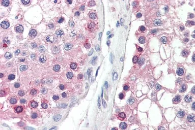 Anti-DYDC1 (aa142-154) antibody, Internal used in IHC (Paraffin sections) (IHC-P). GTX88143