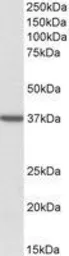 Anti-TOMM40 antibody, Internal used in Western Blot (WB). GTX88159