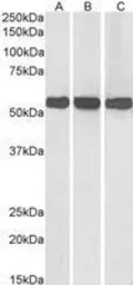 Anti-GLUD1 + GLUD2 antibody, Internal used in Western Blot (WB). GTX88164