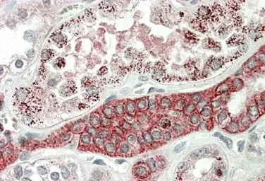 Anti-DCUN1D1 antibody, C-term used in IHC (Paraffin sections) (IHC-P). GTX88168