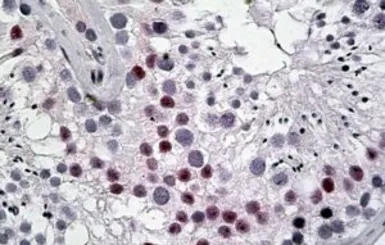 Anti-DENTT antibody, C-term used in IHC (Paraffin sections) (IHC-P). GTX88198
