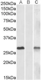 Anti-DYDC1 antibody, Internal used in Western Blot (WB). GTX88205