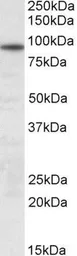 Anti-UNC45B antibody, Internal used in Western Blot (WB). GTX88214