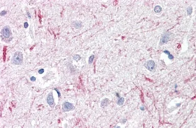 Anti-DTX3 antibody, Internal (near N-term) used in IHC (Paraffin sections) (IHC-P). GTX88228