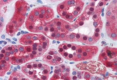 Anti-GPI antibody, Internal (near N-term) used in IHC (Paraffin sections) (IHC-P). GTX88240