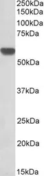 Anti-GPI antibody, Internal (near N-term) used in Western Blot (WB). GTX88240