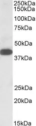Anti-A4GNT antibody, C-term used in Western Blot (WB). GTX88249