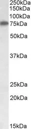 Anti-Arginyl tRNA synthetase antibody, Internal used in Western Blot (WB). GTX88260