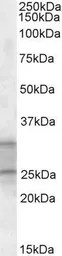 Anti-PEBP4 antibody, C-term used in Western Blot (WB). GTX88268