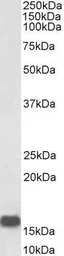 Anti-Neurogranin antibody, Internal used in Western Blot (WB). GTX88301