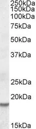 Anti-HMGA2 antibody, Internal used in Western Blot (WB). GTX88326