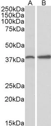 Anti-PRKCDBP antibody, Internal used in Western Blot (WB). GTX88367