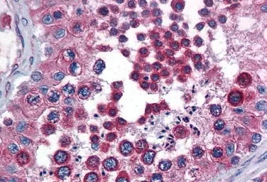 Anti-Calnexin antibody, Internal (near N-term) used in IHC (Paraffin sections) (IHC-P). GTX88369