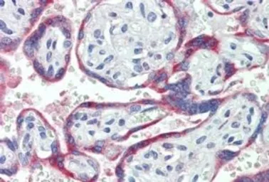 Anti-NOX2 / gp91phox antibody, Internal used in IHC (Paraffin sections) (IHC-P). GTX88404