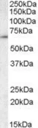 Anti-TCP1 gamma antibody, C-term used in Western Blot (WB). GTX88407