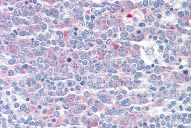 Anti-TCP1 gamma antibody, C-term used in IHC (Paraffin sections) (IHC-P). GTX88407
